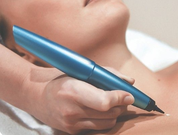 Cryotherapy – Pre & Post Care Guide