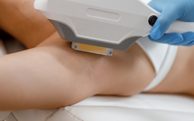 IPL Hair Reduction  – Pre & Post Care Guide